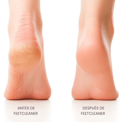 FeetCleaner | Removedor de Impurezas